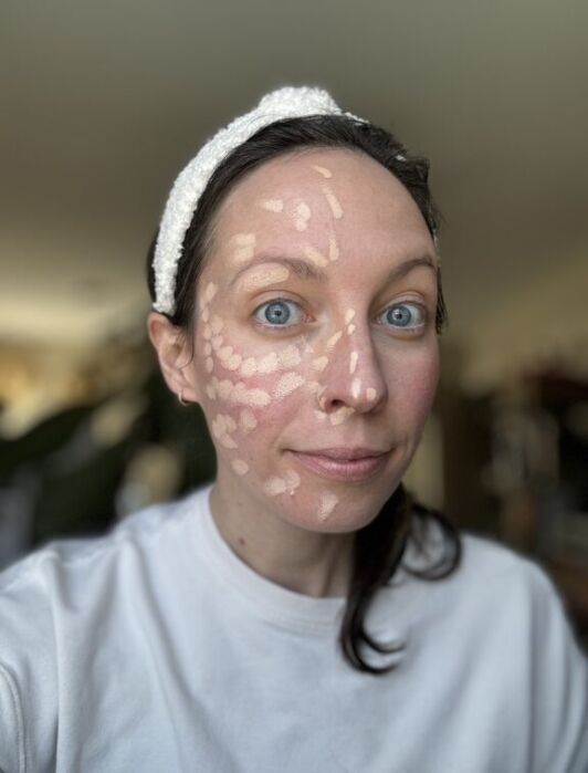 A woman with a white headband and white shirt has dots and lines of beige makeup applied to her face, likely for contouring or concealing.