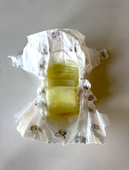 An opened disposable baby diaper with a yellow-stained absorbent pad, lying on a white surface.